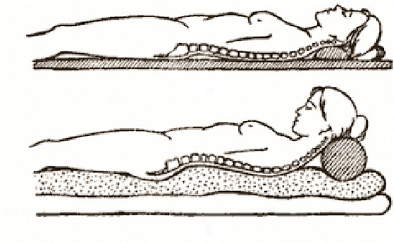 Figura de osteocondrose